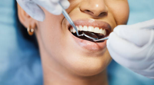Best Dentist for Tooth Abscess  in Huntington, TX